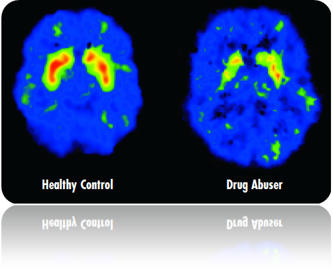 Brain Scans